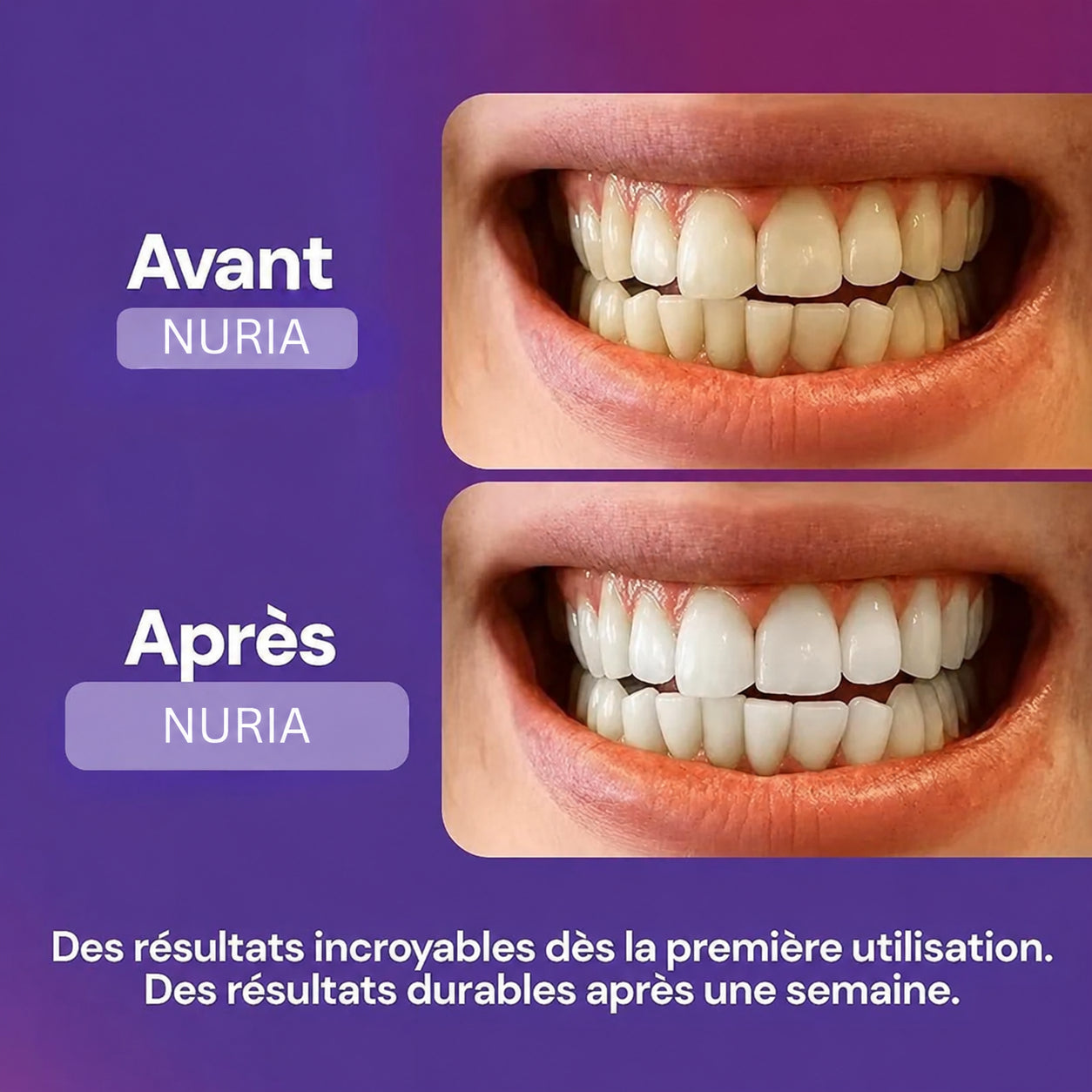 Bandes blanchissantes