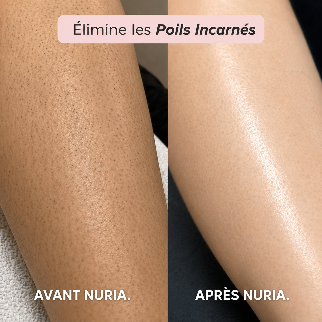 TONDEUSE 2 EN 1 NURIA™ POUR LE MAILLOT ET POUR LE CORPS