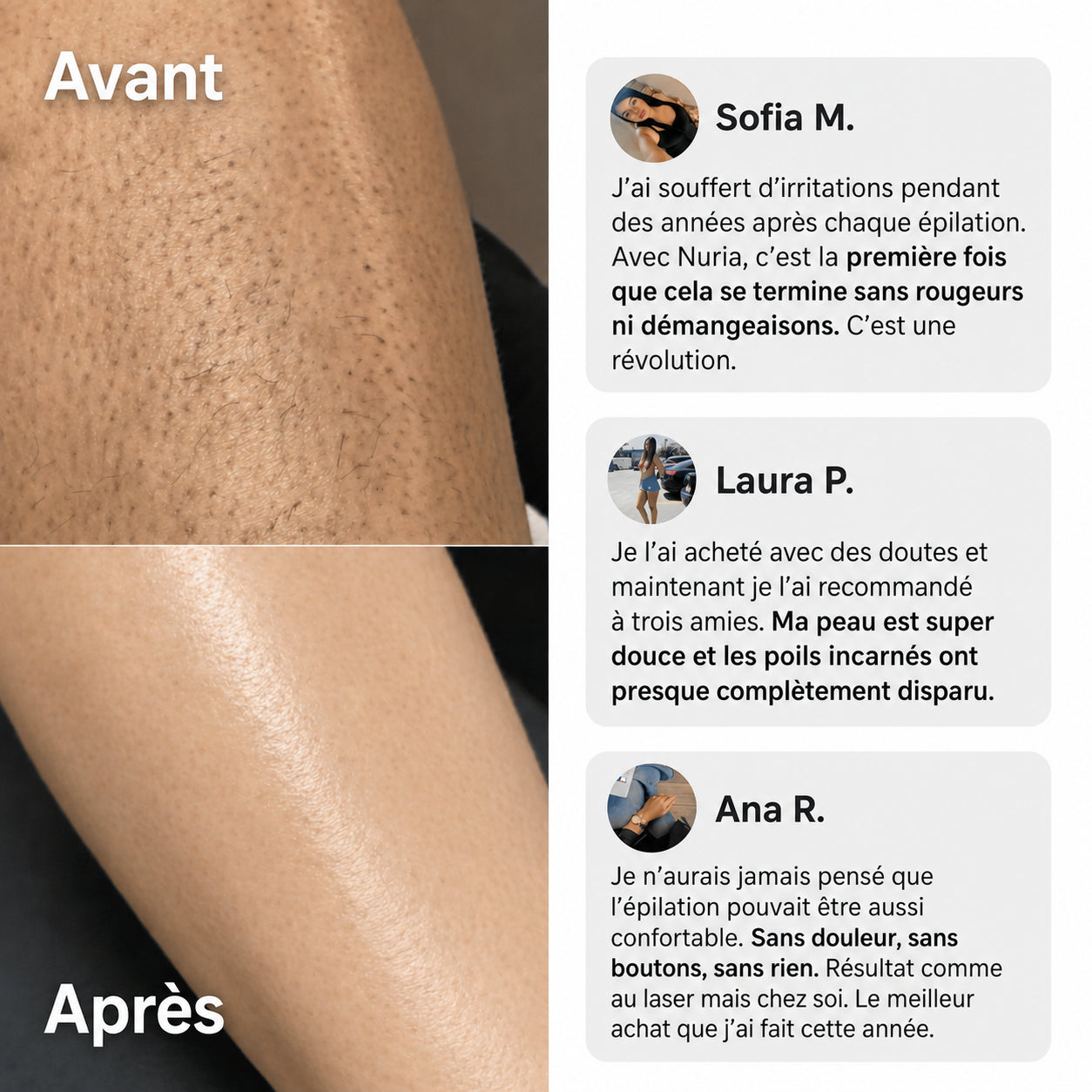 TONDEUSE 2 EN 1 NURIA™ POUR LE MAILLOT ET POUR LE CORPS